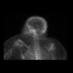 shuman fig.3