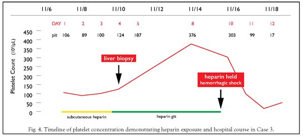 thrombocytopenia