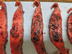 covid fetal demise